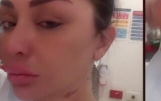 victim-of-alleged-acid-attack-in-sydney-posts-videos-of-incident-on-tiktok