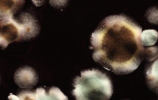 some-of-us-are-more-vulnerable-to-mould-allergies-than-others.-here’s-what-symptoms-to-look-out-for