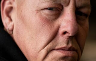 mostyn-is-avoiding-life-saving-surgery-because-he’s-scared-he-won’t-receive-the-care-he-needs