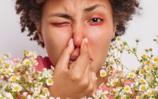 itchy-eyes?-runny-nose?-it’s-probably-hay-fever-—-but-don’t-blame-the-wattles