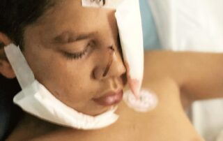 family-outraged-after-13-year-old-boy-bitten-in-the-face-by-police-dog,-causing-severe-injuries