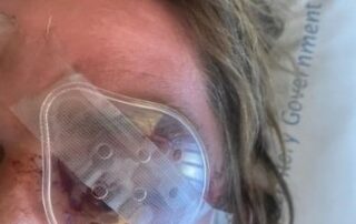 tow-truck-driver-at-risk-of-losing-sight-after-random-rock-attack-in-alice-springs