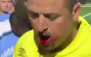 soccer-spectator-accused-of-punching-out-teeth-of-referee-in-‘outrageous-attack’-refused-bail