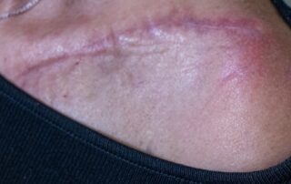 ‘there-was-no-opportunity-to-stop’:-a-collision-with-a-kangaroo-left-avid-cyclist-liz-with-serious-injuries