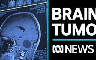 zac-dumesny-aims-for-sanfl-return-after-cancer-ordeal