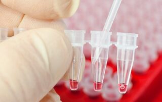 a-vital-ingredient-for-cancer-research-is-in-tight-supply-with-the-price-rising