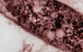 ‘extremely-concerning’-tuberculosis-outbreak-in-far-north-south-australia-prompts-testing-blitz