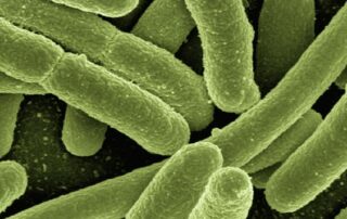 remote-wa-community-still-waiting-for-urgent tuberculosis-testing-nine-months after-19yo’s-death