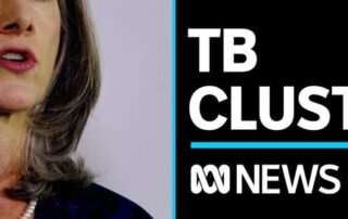 latent-tuberculosis-(tb)-diagnosed-in-39-people-in-sa