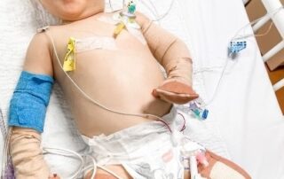 he-fought-for-his-life-and-underwent-multiple-amputations,-but-ryan-is-still-his-‘cheeky’-self