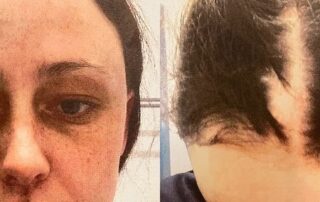 woman-accused-of-‘pulling-actual-clumps-of-hair’-out-of-police-officer’s-scalp-pleads-not-guilty