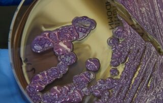 scientists-make-promising-breakthrough-against-superbug-that-attacks-australian-icu-patients