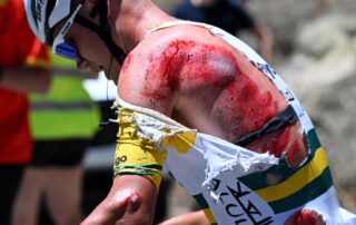 aussie-star-out-of-tour-down-under-after-suffering-brutal-road-rash,-as-french-rider-shares-photo-of-his-horrific-injuries