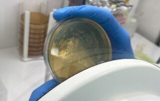 unlocking-the-code-of-the-‘super-pooper’-could-usher-in-new-wave-of-gut-health-treatments