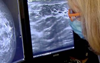 mammogram-results-delayed-as-breast-screening-service-urgently-seeks-more-radiologists