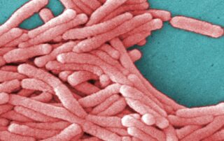 why-is-this-‘first-world-disease’-becoming-more-common?-scientists-aren’t-certain