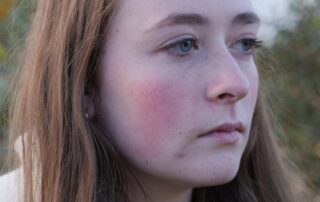 pots-cases-are-rapidly-on-the-rise,-but-diagnosing-it-takes-years