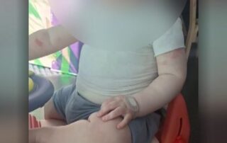 the-baby’s-parents-say-his-recovery-will-take-years